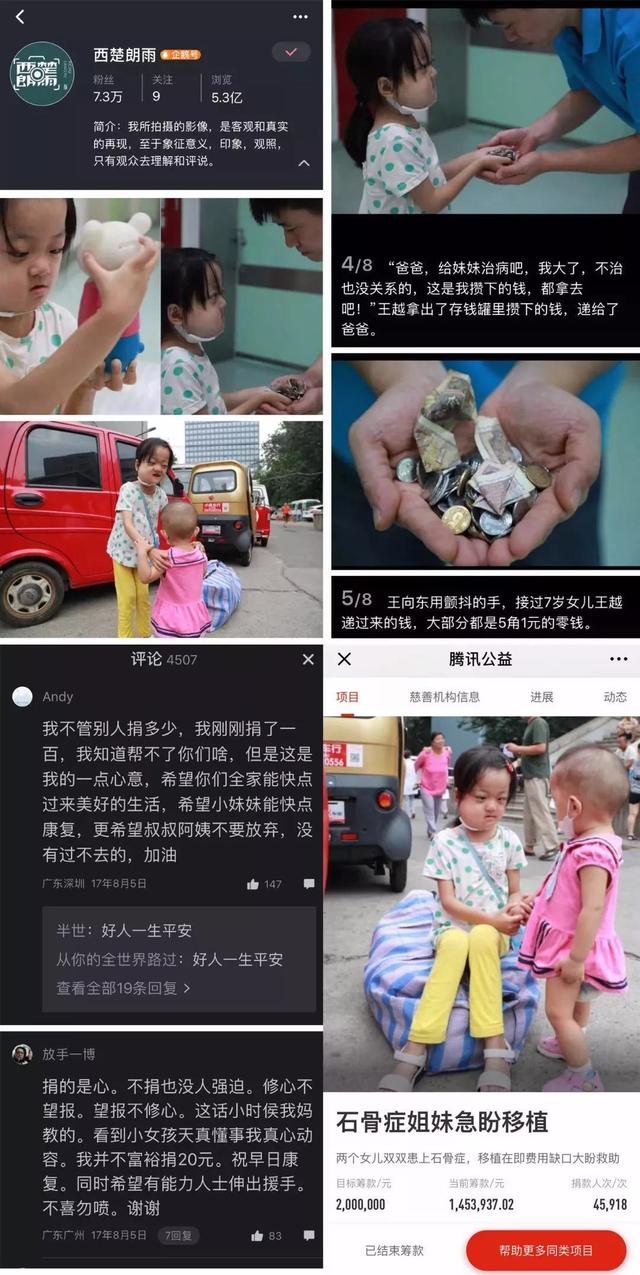 重生的喜悦 | 罕见病姐妹花救助近三年，冬日温暖回归探班9958